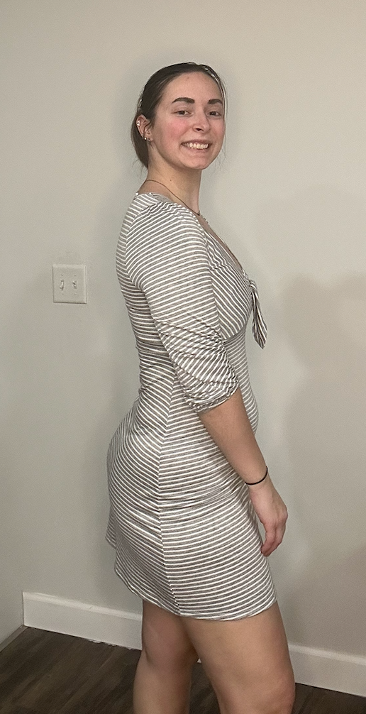 Striped Tie-Front Dress – Chic Casual Day-to-Night Outfit
